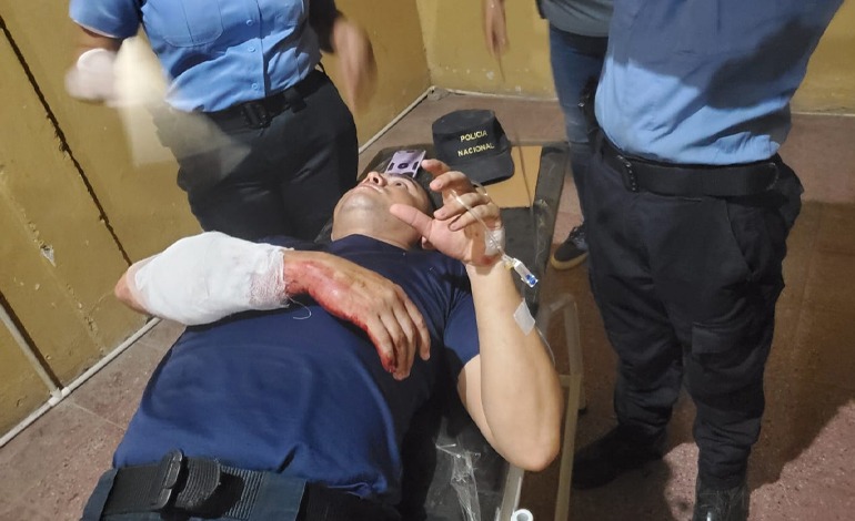 3 policías heridos en enfrentamiento de&nbsp;“bolos”