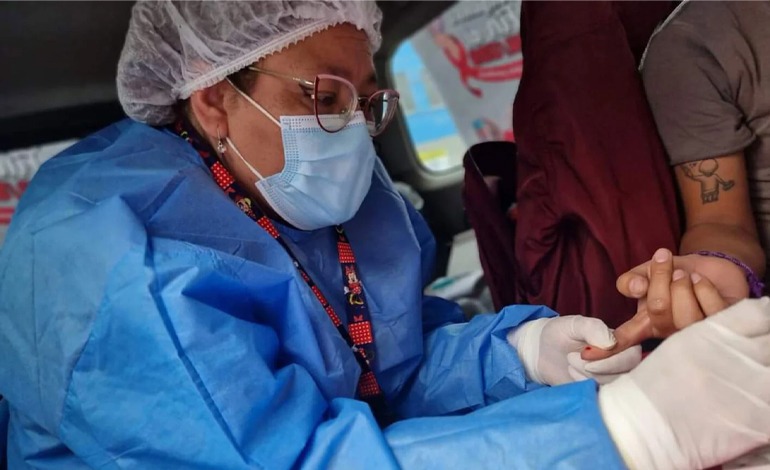 Viruela símica levanta las alertas en&nbsp;Salud