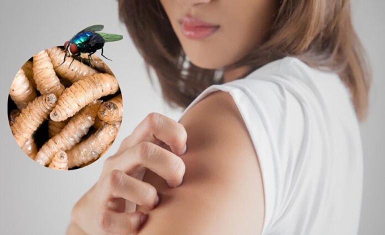 27 casos de gusano barrenador en&nbsp;humanos