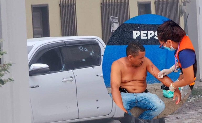 Asesino sin puntería: En atentado de 18 balazos, sólo le hirió el&nbsp;brazo